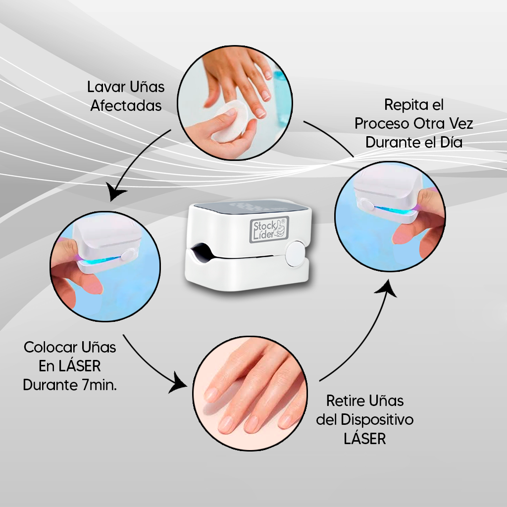 LumiNail Pro: Uñas perfectas con tecnología láser