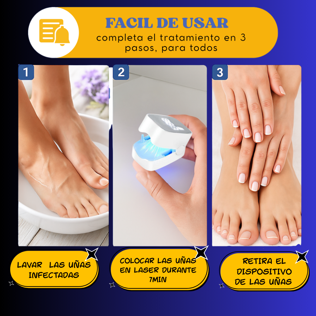 LumiNail Pro: Uñas perfectas con tecnología láser