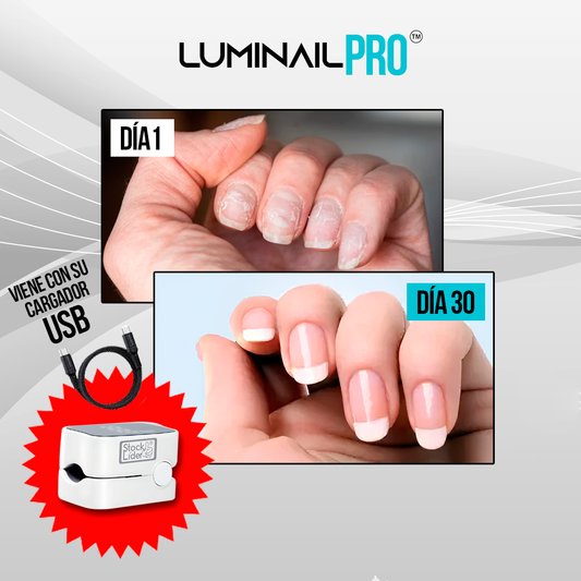LumiNail Pro: Uñas perfectas con tecnología láser